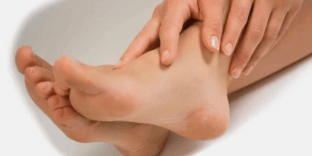 Nagų grybelio gydymas