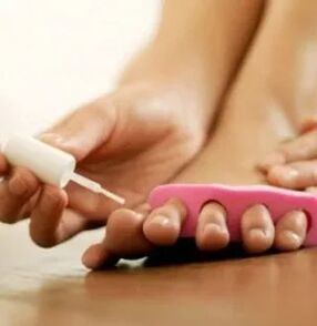 Terapinio lako taikymas